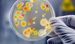 Endo agar